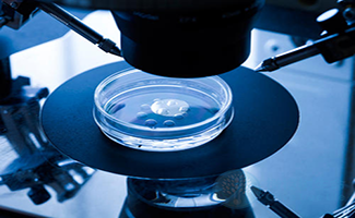 极光生殖